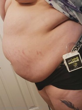 babydollbelly Nude Leaks OnlyFans Photo 18